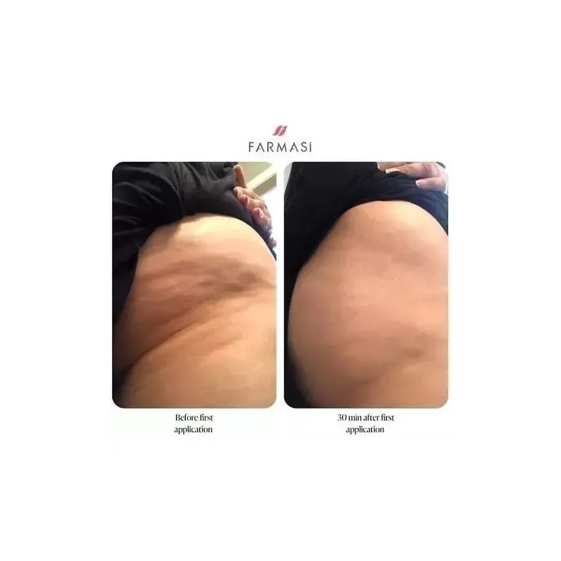 Corporal Modeladora Flaunt It Reduce Talla Y Celulitis