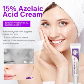 3PCS Crema Ácido Azelaico, Suero Ácido Azelaico, Sérum Facial con 15% de Ácido Azelaico, Hidratación Diaria, Calma La Piel, Textura Ligera