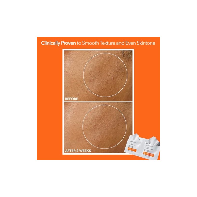 Dr. Dennis Gross Skincare Alpha Beta Peel Original Formula Packets,