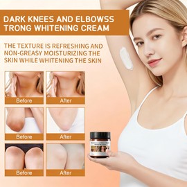 Dark Knee Remover, Body Moisturising Lotion for Dark Toe Joint Care, Suitable for Underarms, Elbows, Inner Thighs, Neck, Intimate Areas, Leg Skin Care Cream