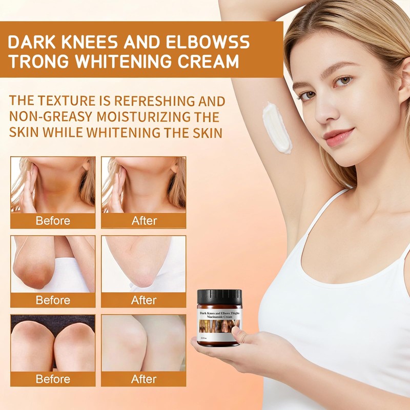 Dark Knee Remover, Body Moisturising Lotion for Dark Toe Joint