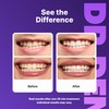 DRDENT Purple Teeth Whitening Strips 21 Treatments - Enamel Safe