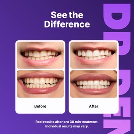 DRDENT Purple Teeth Whitening Strips 21 Treatments - Enamel Safe Whitening - Non Sensitive Formula - Gentle Whitening Care - Pack of 42 Strips
