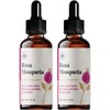 Árbora Aceite de Rosa Mosqueta puro anti-edad atenúa estrías 2