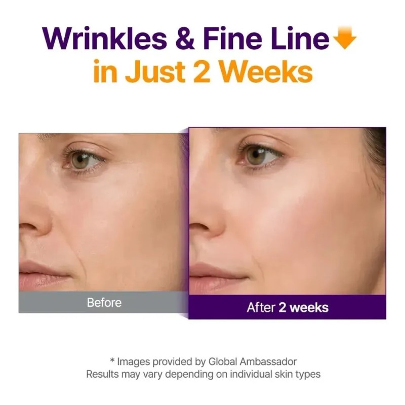 A Sérum Facial Antienvejecimiento Purito Retinol 0.1% + .