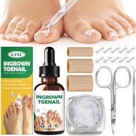 Ingrown Toenail Kit - Ingrown Toenail Drops, Ingrown Toenail Set - 60 Pcs Toenail Straightener Strips -Toenail Lifter Small Scissors