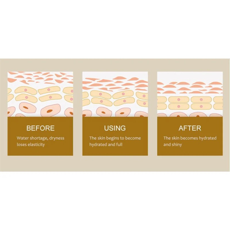 Cápsulas De Suero Hialurónico, Hidratante Facial, Cápsula Fa