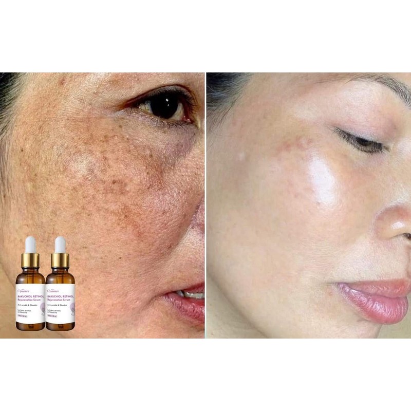 Retinol Venature Bakuchiol Retinol Rejuvenation Serum- 30ml