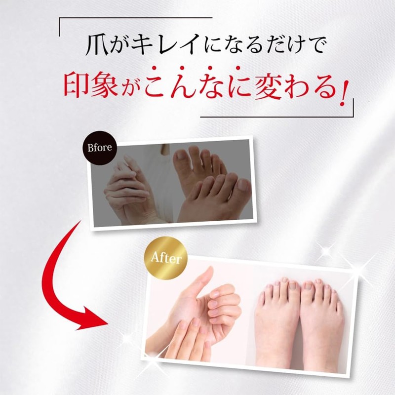 リボネルEXプレミアム 指定医薬部外品 爪 の 洗浄 消毒 2本約2ヶ月分 [ ヒアルロン酸 サラシミツロウ