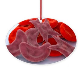 CafePress Sickle Cell Anaemia, Artwork Oval Wood Ornament, 5.25" W x 3.5" H