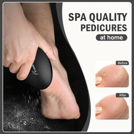 FVION Nano Glass Foot File Callus Remover – Gentle Glass Foot Hard Skin Foot Scraper, Effective Feet Scrubber for Dead Skin, and Portable Pedi Egg Foot Care Tool (Black)