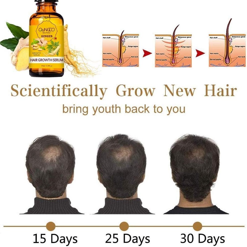 Tratamiento de pérdida de cabello Esencia de crecimiento del cabello