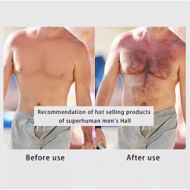 Tratamiento Concentrado Barba Bigote Estimular Crecimento 30