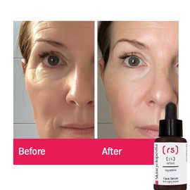 Skincyclopedia Retinol & Squalane Face Serum, Brightens Skin Tone, Anti Wrinkle.