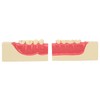 Right Lower Posterior Tooth Model 2X Magnification Detachable Resin Tooth