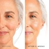 Suero de retinol con ácido hialurónico hidratante para arrugas y