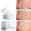 [Removal effect MAX] Acne cream, natural plant ingredient repair cream, improves sensitive skin, 1 piece, 30g / [제거효과 MAX]여드름 크림 천연 식물 성분 리페어 크림 민감피부 개선, 1개, 30g