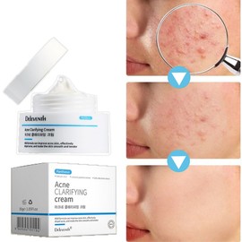 [Removal effect MAX] Acne cream, natural plant ingredient repair cream, improves sensitive skin, 1 piece, 30g / [제거효과 MAX]여드름 크림 천연 식물 성분 리페어 크림 민감피부 개선, 1개, 30g