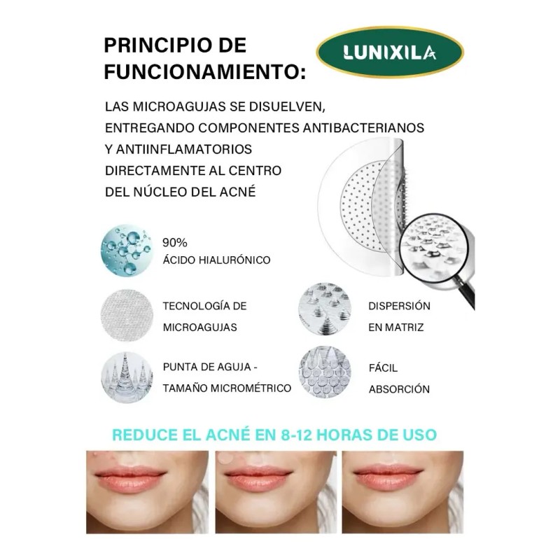 Parches Acne Con Micropuntos Granos,barros,día Y Noche Acneica Día/nocheAdecuado para