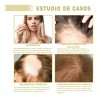 5pzs 60ml Aceite Vegano Natural Para Crecimiento De Cabello