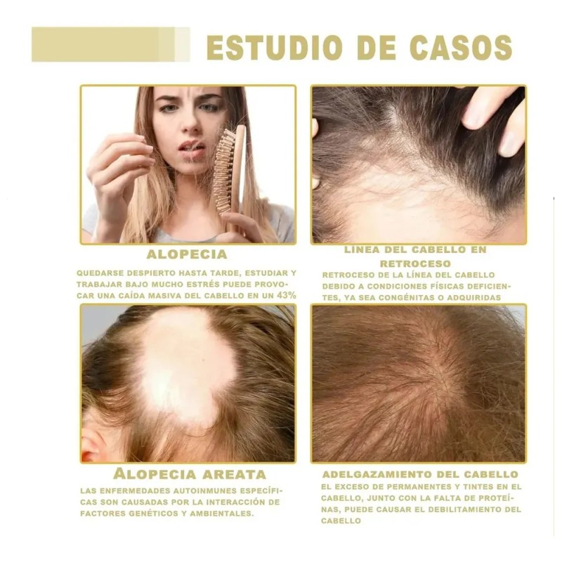 5pzs 60ml Aceite Vegano Natural Para Crecimiento De Cabello