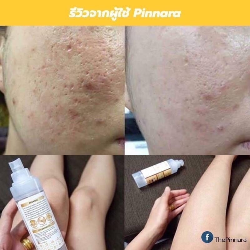 Pinnara Coconut Oil Serum 85ml🇹🇭🌟