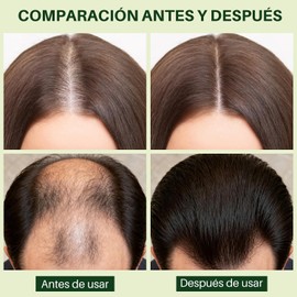 Aceite de Romero,Aceite de Romero para El Cabello,aceite para el cabello,Promover el crecimiento del cabello, apto para pestañas, cejas y cabello dañado (60ml por frasco).