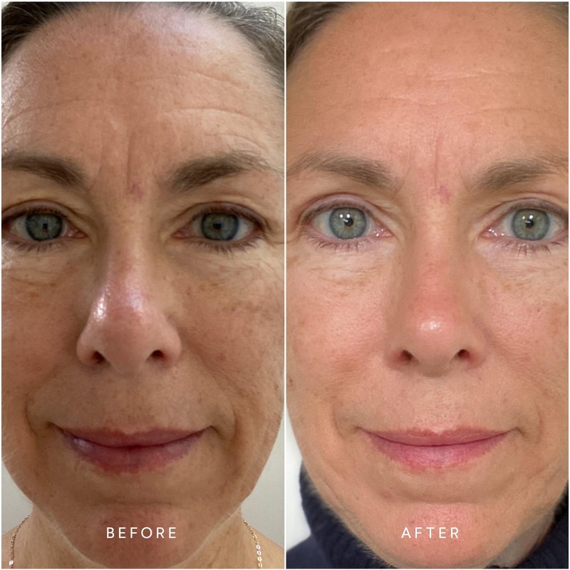 True Botanicals - RENEW Chebula Active Serum | Clean, Non-Toxic,