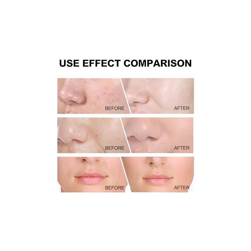 Gentle Nourishing Skincare Set – 8-Piece Complete Skincare Routine for