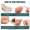 3pcs Ingrown Toenail Clippers Set, Professional Beveled Eagle Beak Nail