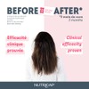 Nutricap Gummies Biotin 5000 mcg - Hair Growth & Nail