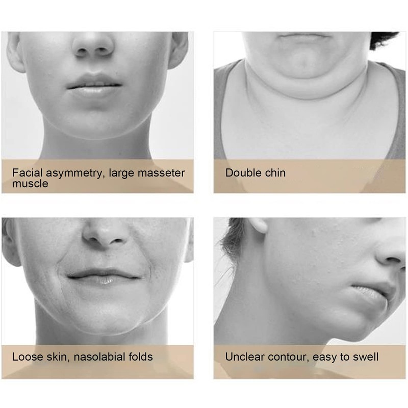 V-Face Machine, Facelifting Device to Reduce Double Chin with Remote