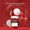 Varicose Veins Relief