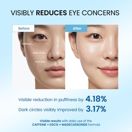 Dongyu Eye Cream for Dark Circles: Korean Caffeine Eye Cream Daily Morning Skincare - Puffy Eyes Treatment for Beauty Enthusiasts (Blue)