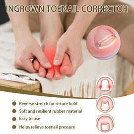 Ingrown Toenails Set, Nail Clip, Toenails, Pack of 180