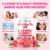 L-Lysine 1000mg Gummies for Immune Support & Skin Health -