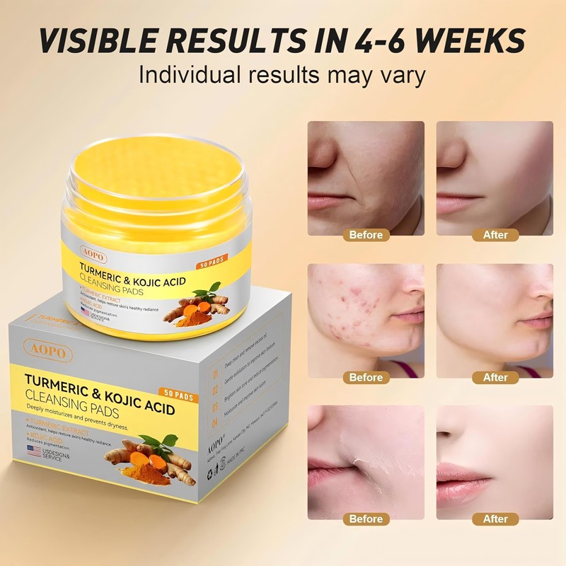 Kojic Acid and Turmeric Cleansing Pads, 50 Pcs, for Face