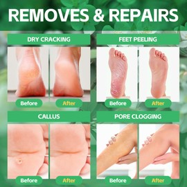 nbc BeautiLab Pedicure Foot Soak, Foot Spa Soak, Pedicure Kit, Bubble Foot Bath for Tired & Dry Cracked Feet, Athletes Feet, Odor Foot and Softens Calluses, Foot Soak 16 Packs A Box, Jasmine