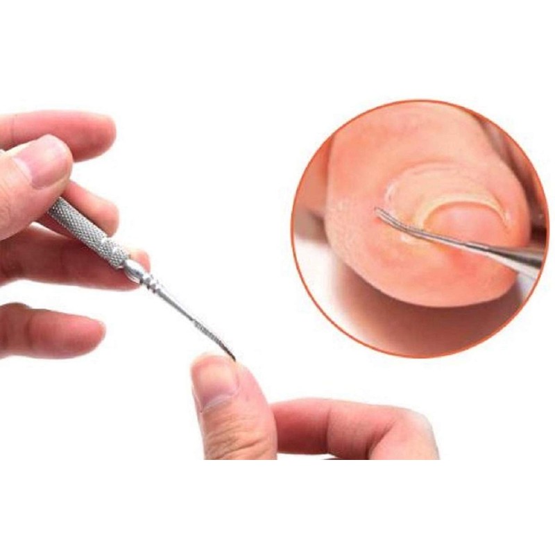 Ingrown Nail Care File & Lifter 2-Way Foot Zonde 5.0