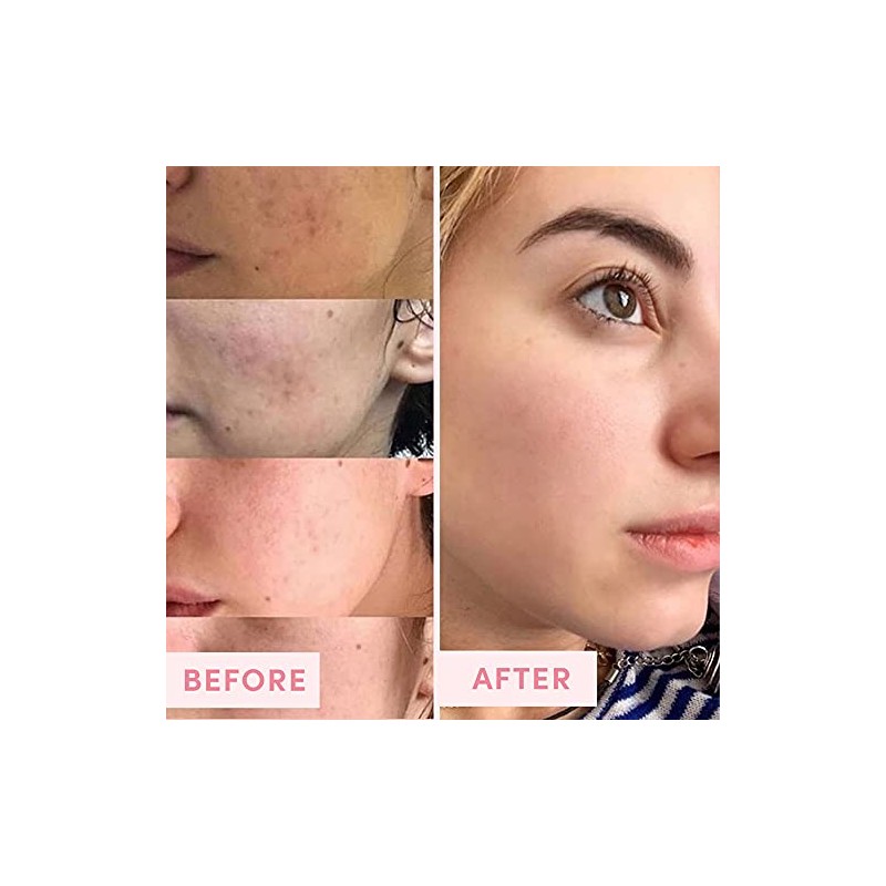 Sand & Sky Brilliant Skin Purifying Pink Clay Mask