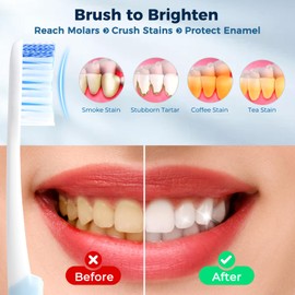 Oralphi Pro Stain Eraser Medium Toothbrushes for Adults, Whitening Toothbrush with Spiral Medium Bristles for Smoke Tea Coffee Stain, Deep Plaque Removal, Rounded Bristle Tips for Gentle Cleaning