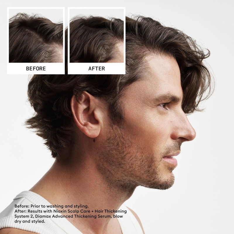 Nioxin Scalp + Hair Thickening System 2 Trial Kit