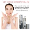 Blemish Spot Treatment Cream - Gentle Serum For Pimples,
