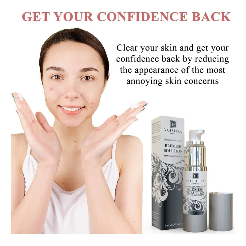 Blemish Spot Treatment Cream - Gentle Serum For Pimples,