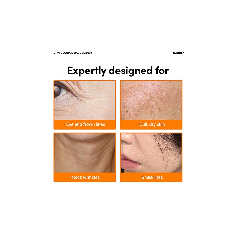 FRANKLY [FRANKLY]PDRN Bounce Ball Serum 30ml