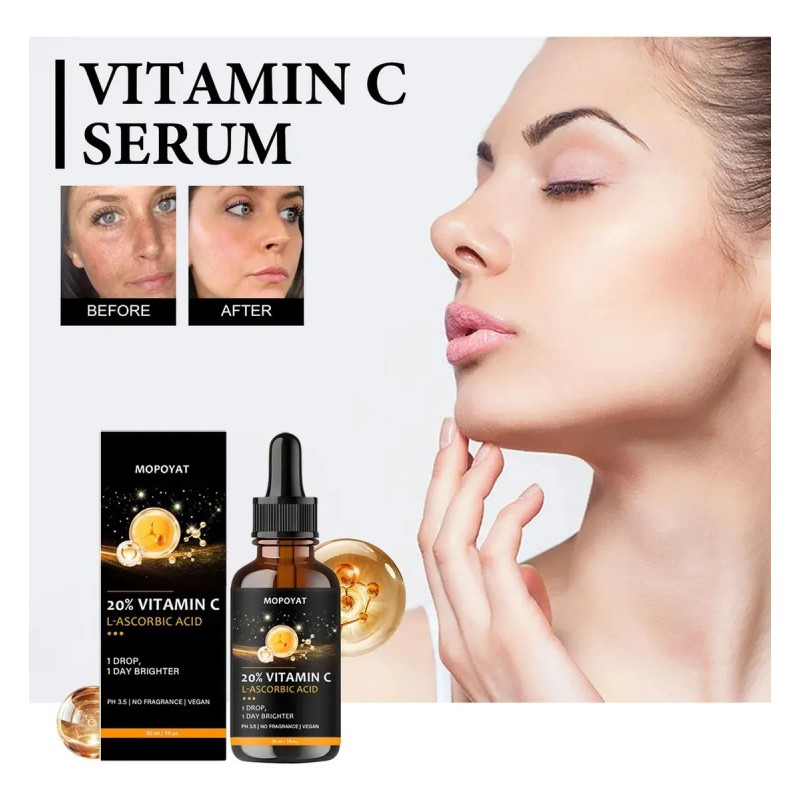 Mopoyat - Srum Facial Con Vitamina C, Hidrata Y Nutre