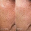 Medik8 Crystal Retinal 6 - Anti-Ageing Retinol Cream for Radiant