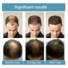 Fortalece Las Raíces Del Cabello Alpha Infuse Advanced /