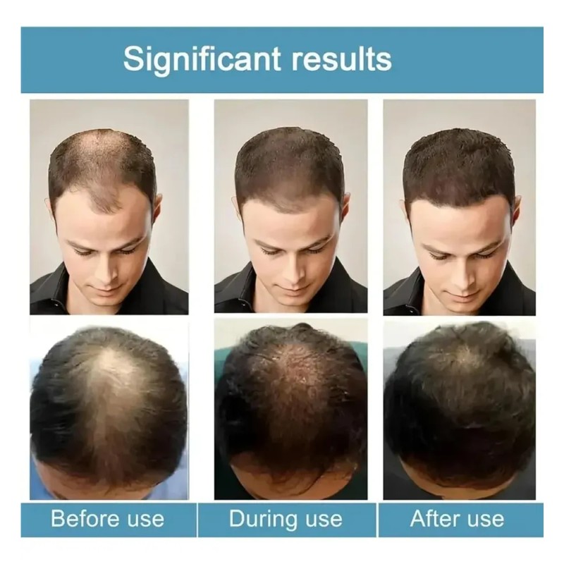 Fortalece Las Raíces Del Cabello Alpha Infuse Advanced /