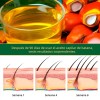 10pc Weud Battana Aceite Capilar Nutrir Para Cuero Cabelludo